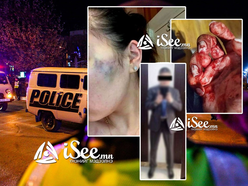 Монголын томоохон банкны эзэн БХ загвар өмсөгч бүсгүйг зодож, хүнд гэмтээжээ