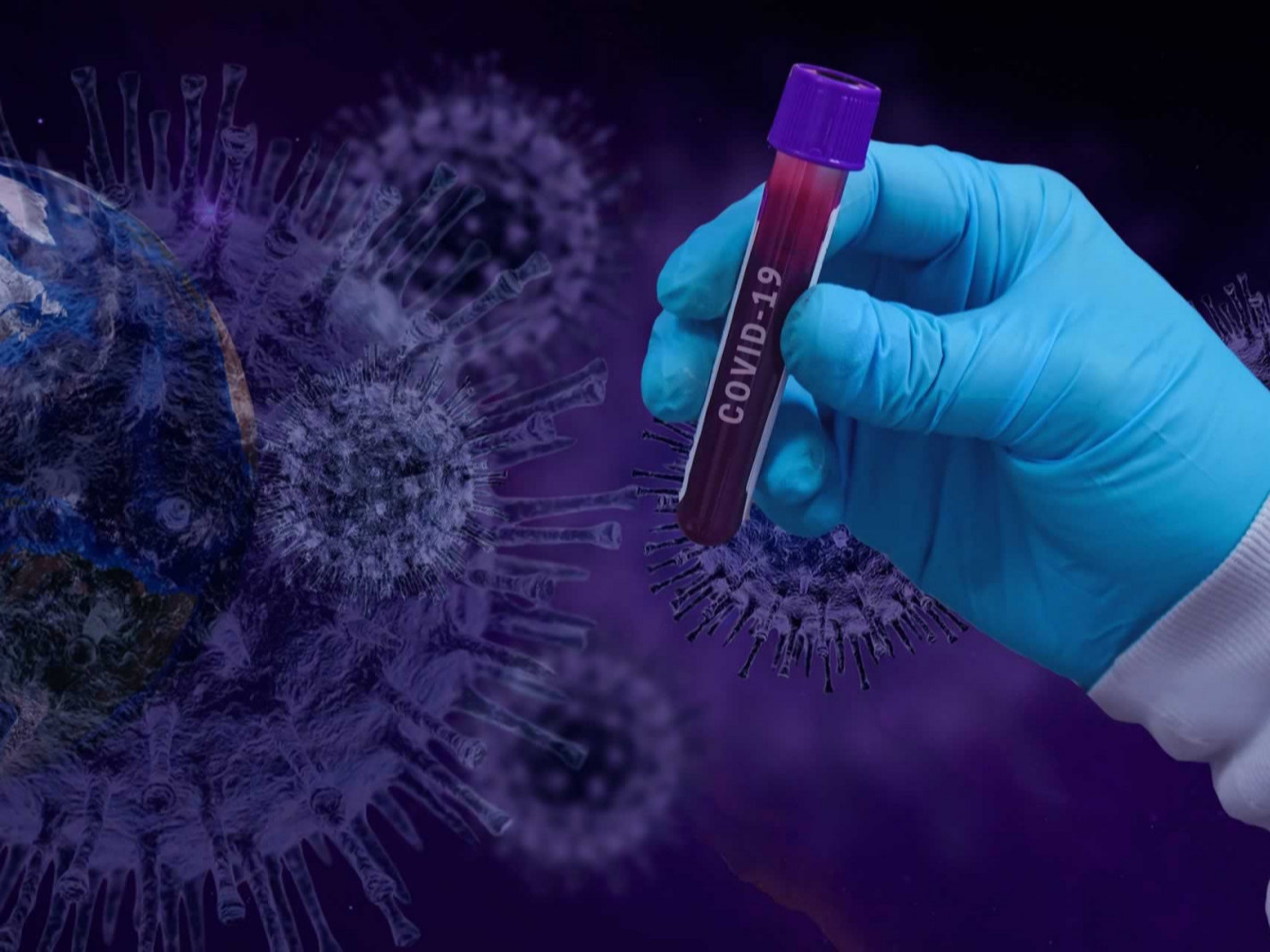 Их Британид хүнээс хүнд илүү хурдан халдаж болзошгүй коронавирусийн шинэ төрөл илэрчээ