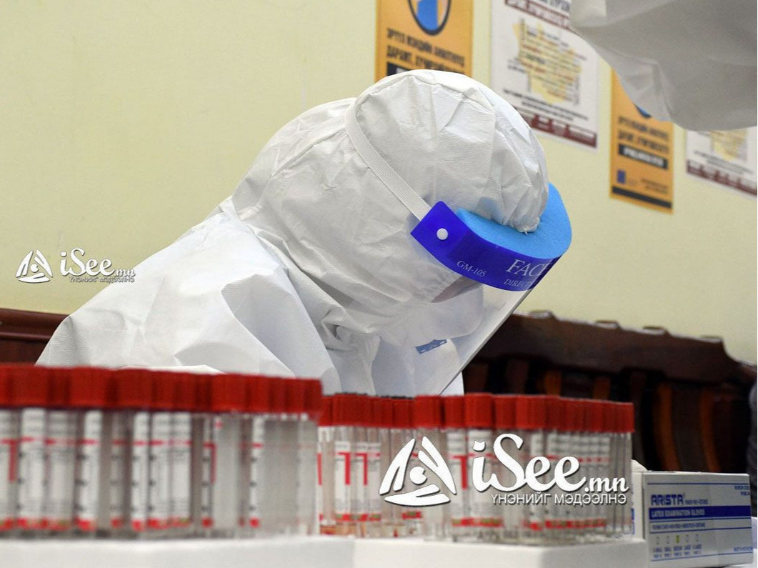 ЭМЯ: Улаанбаатарт 808, орон нутагт 857 хүнээс халдвар илэрч, 15 хүн эндлээ