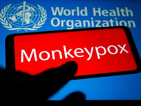 ДЭМБ: Сармагчны цэцэг өвчний 35 мянга гаруй тохиолдол дэлхийн 92 улс оронд илэрч 12 хүн нас бараад байна