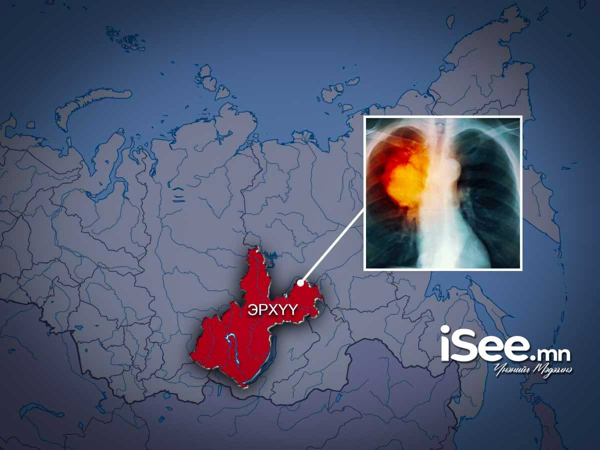 Оросын тал мэдээлэл өгөхөөс татгалзаж, АНУ мэдээлэл авахын тулд шахалтаа нэмэгдүүлжээ